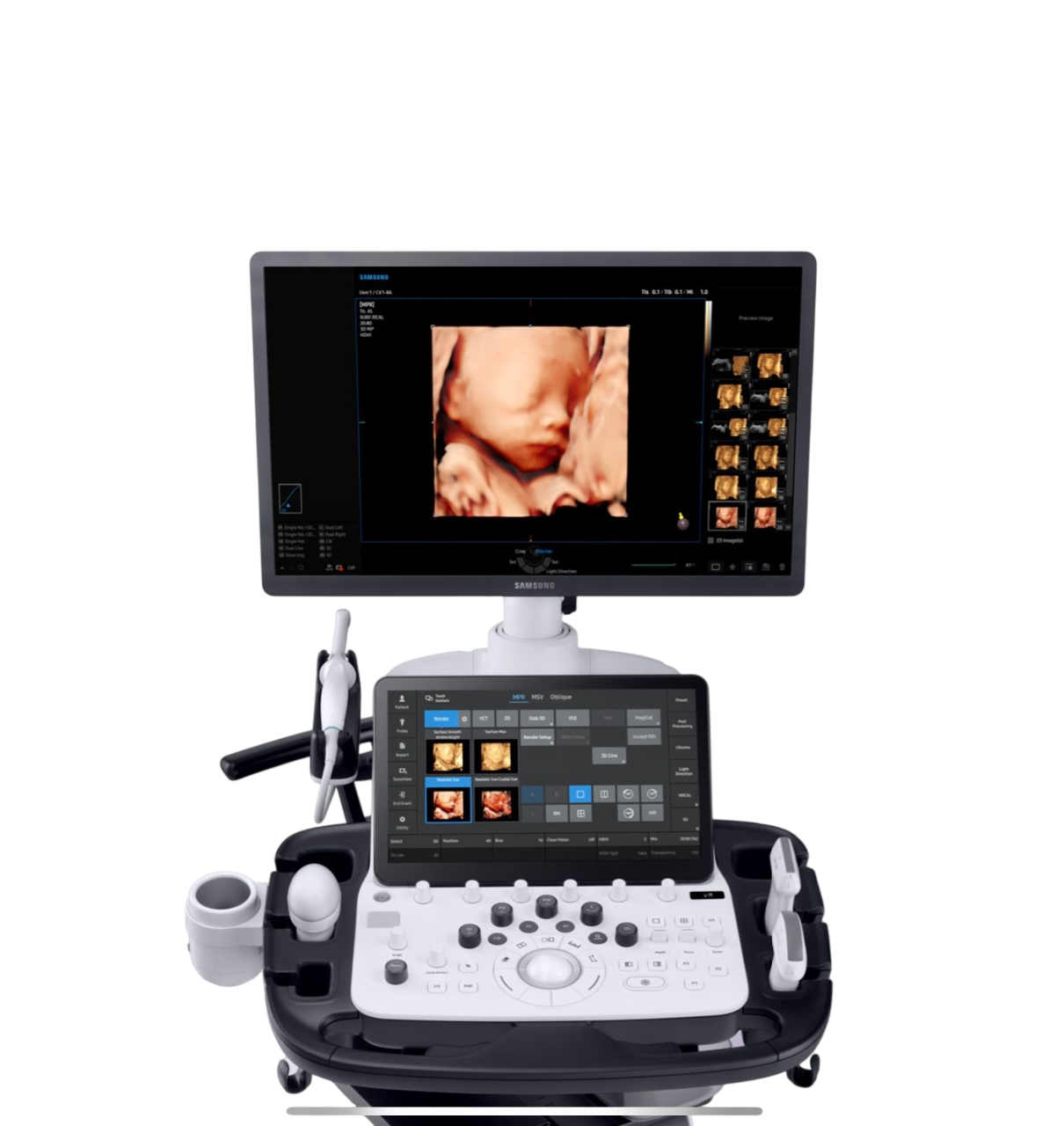 Sistema de Ultrasonido Samsung V8